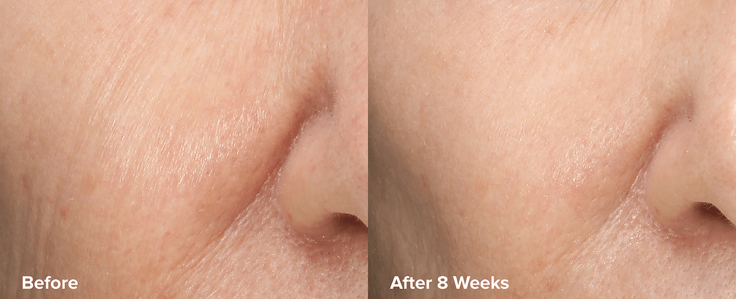 SKIN PERFECTING Ексфолиант 6% Манделова + 2% Млечна Киселина - ГОДНОСТ 04.2026