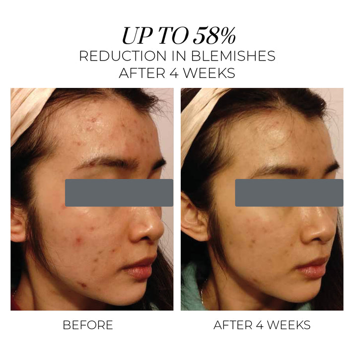 Violet Water Hydra-Gel Крем за Проблемна Кожа