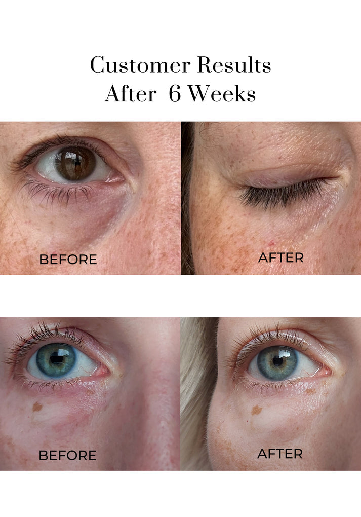 Eye Wonder Nutri-Active Eye Serum Околоочен Серум