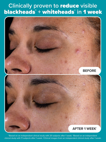 Skin Perfecting 2% BHA Liquid - Течен Ексфолиант с 2% ВНА