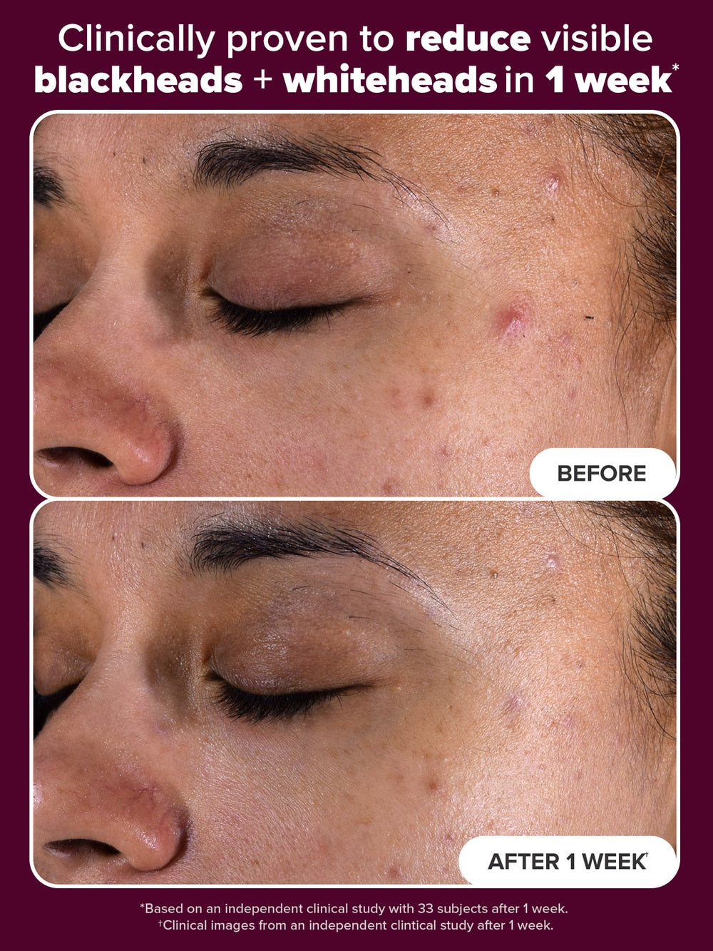 Skin Perfecting 2% BHA Liquid Exfoliant Limited Holiday Edition