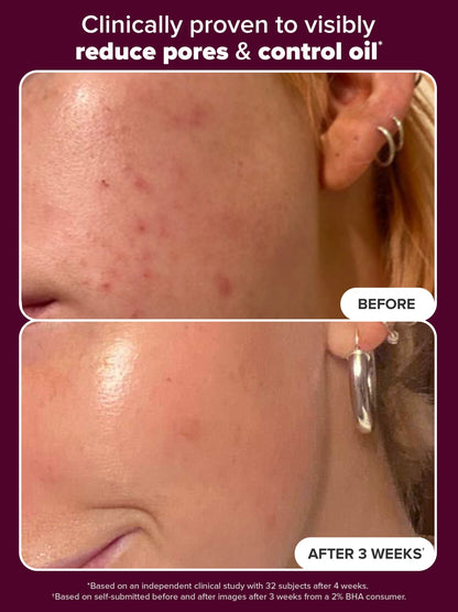 Skin Perfecting 2% BHA Liquid Exfoliant Limited Holiday Edition