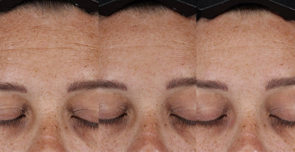 Clinical Pro Retinaldehyde Dual-Retinoid Treatment - Двойна Ретиноидна Терапия