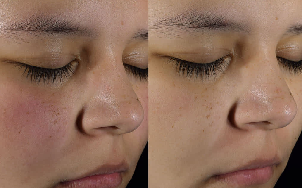 Skin Perfecting 2% BHA Liquid - Течен Ексфолиант с 2% ВНА