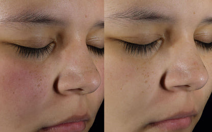 Skin Perfecting 2% BHA Liquid - Течен Ексфолиант с 2% ВНА