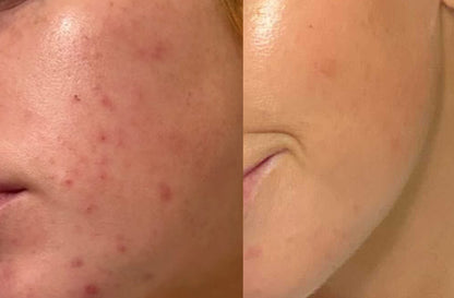 Skin Perfecting 2% BHA Liquid - Течен Ексфолиант с 2% ВНА