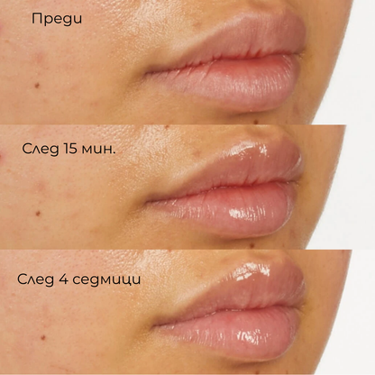 Pro-Collagen Peptide Gloss Balm - Пептиден Балсам за Свежи Устни - Sheer Pink