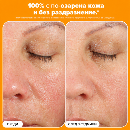 Boost С15 Super Booster - 15% Витамин С и Пептиди