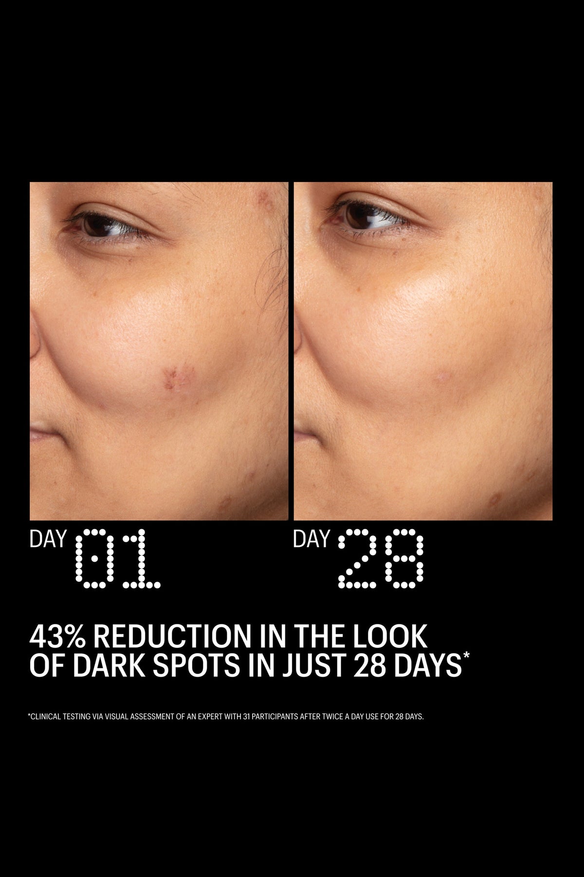 Azelaic and Kojic Advanced Clarifying - Азелаинов Серум с Коджик Киселина