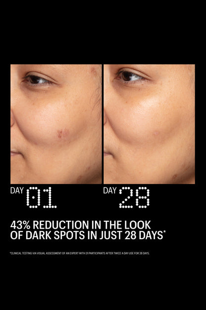 Azelaic and Kojic Advanced Clarifying - Азелаинов Серум с Коджик Киселина