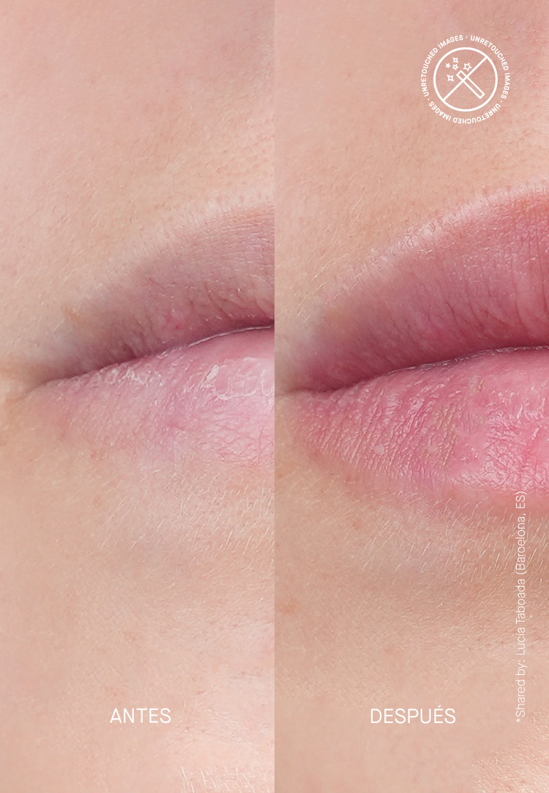 Volume Hydro Plump - Терапия за Обемни Устни