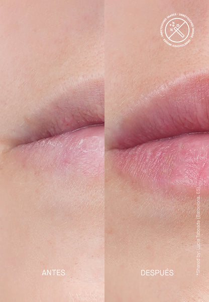 Volume Hydro Plump - Терапия за Обемни Устни