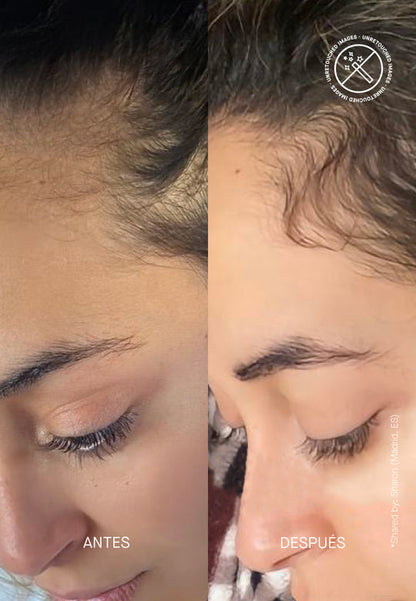 Hair Density Scalp Treatment - 3 в 1 Серум за Сгъстяване на Косата