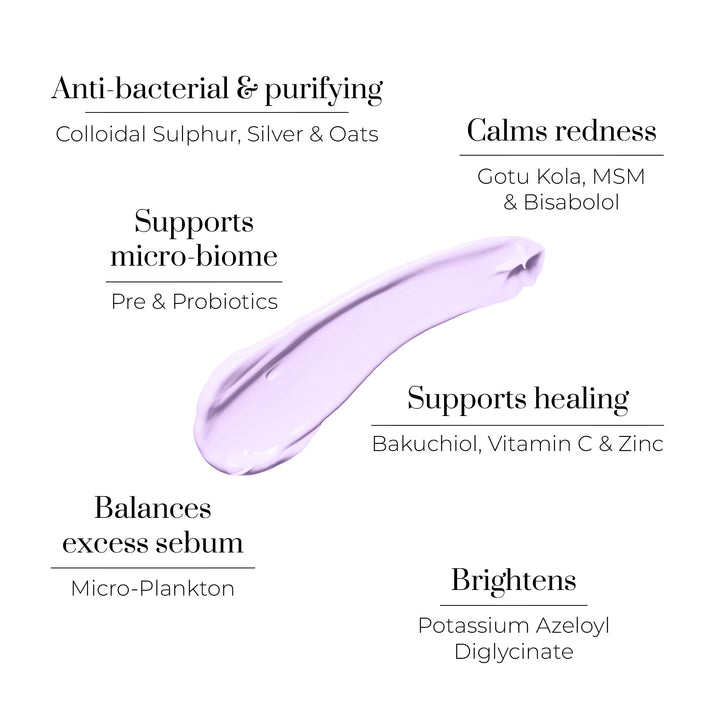 Violet Water D-Spot - Локална Терапия за Изсушаване на Пъпки