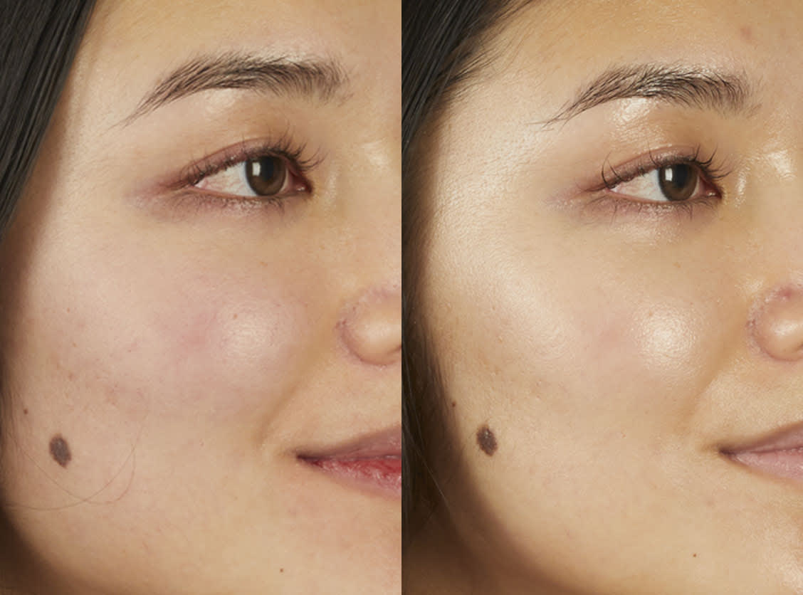 7% Ectoin + Hyaluronic Acid Milky Hydrating Serum - Бариерен Млечен Бустер със 7% Ектоин - ‼️ДОСТАВКА СЛЕД 26.11.25‼️