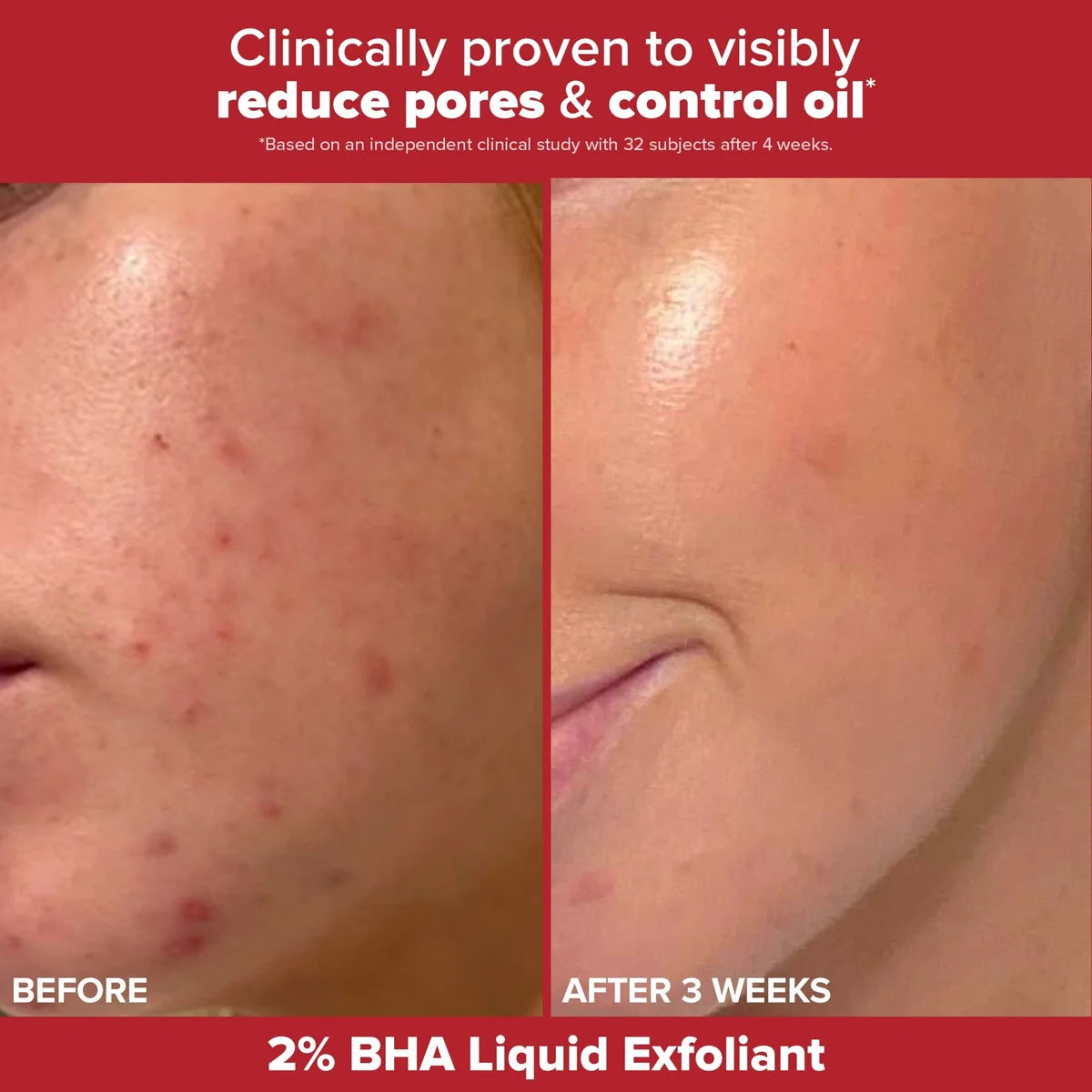 The Breakout Resolution Kit