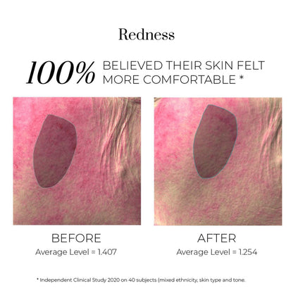 Isotonic Hydra-Serum  Intense Bio-Mimetic Hydrating Serum - Интензивен Биомиметичен Хидратиращ Серум